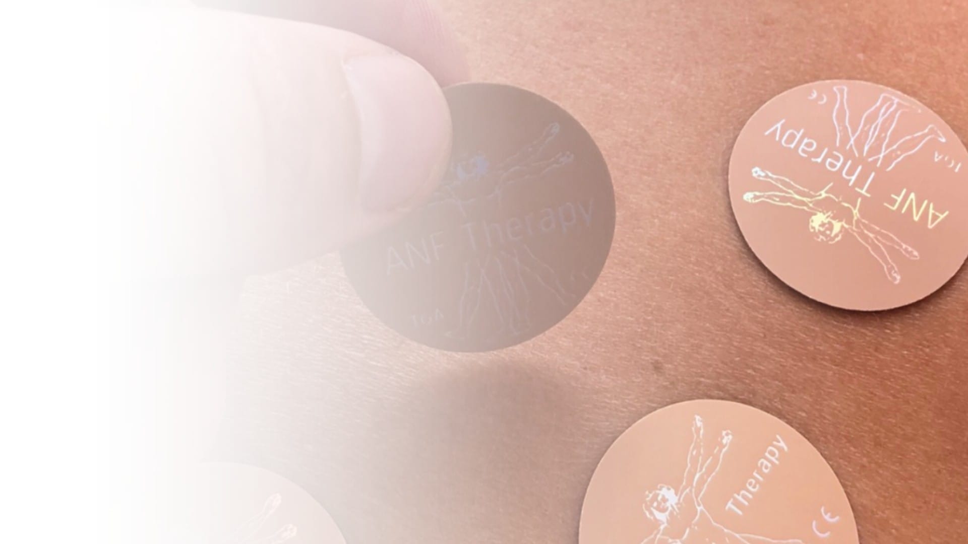 ANF Devices