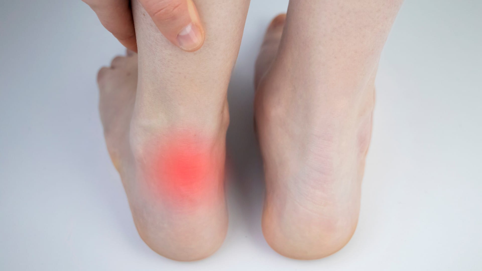 Sever’s Disease or Achilles Tendonitis