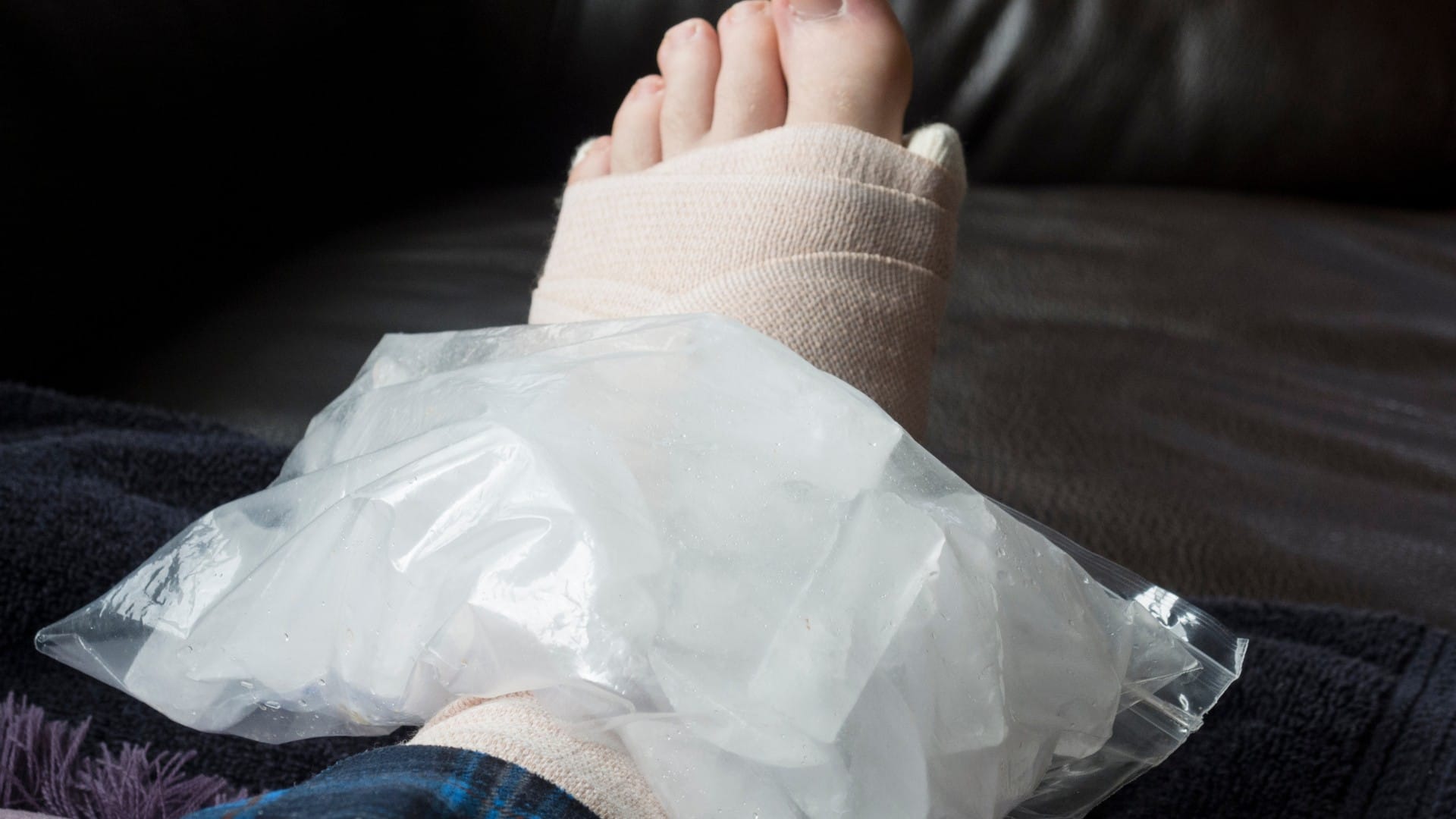 Foot Sprain RICE