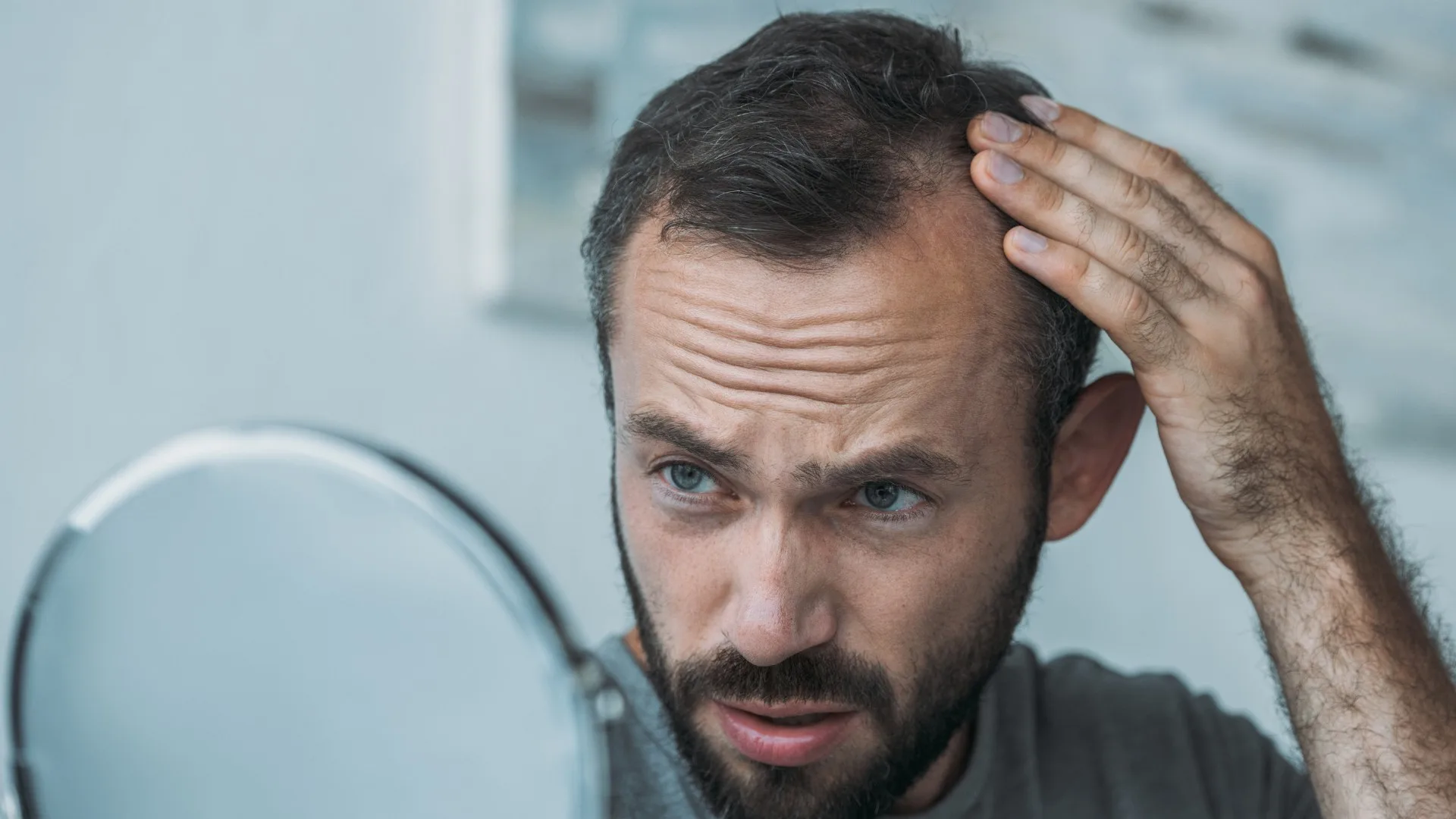 low-dopamine hair loss