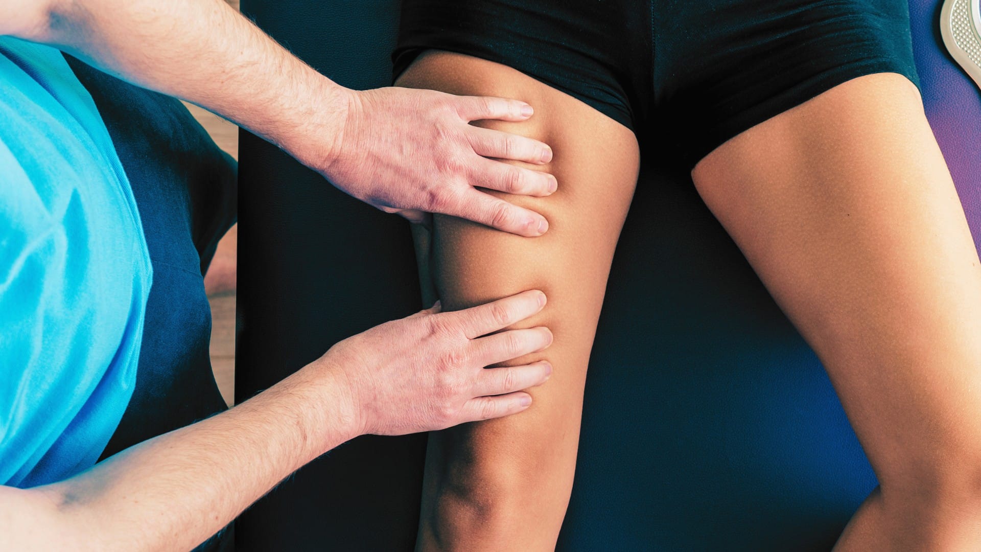 What are quadriceps