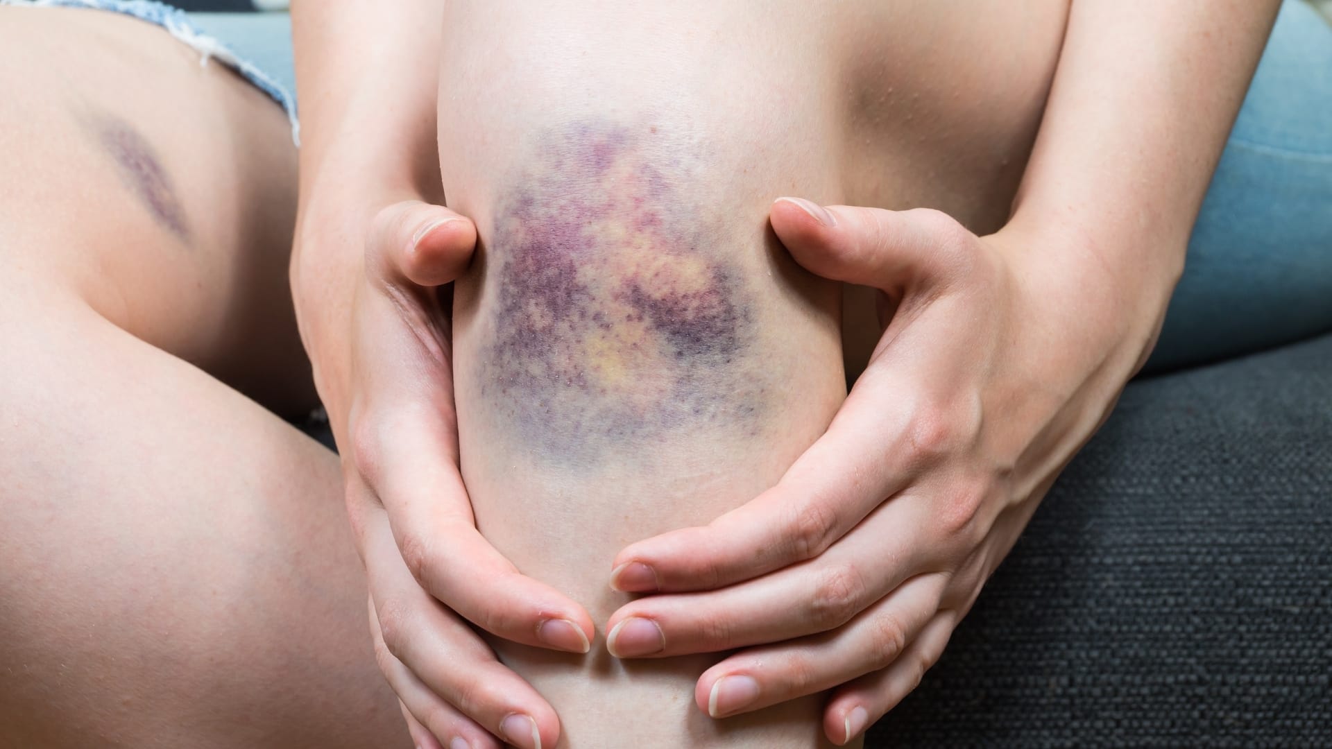 Symptoms to Watch For