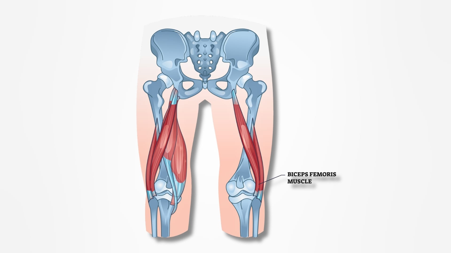 Understanding the Anatomy_ The Biceps Femoris Muscle